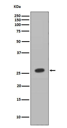 Anti-HOXB9 Rabbit Monoclonal Antibody