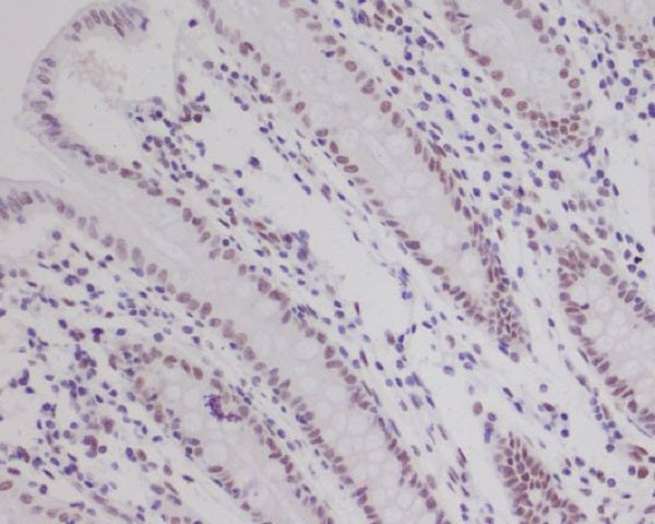 Anti-HIF1 beta Rabbit Monoclonal Antibody