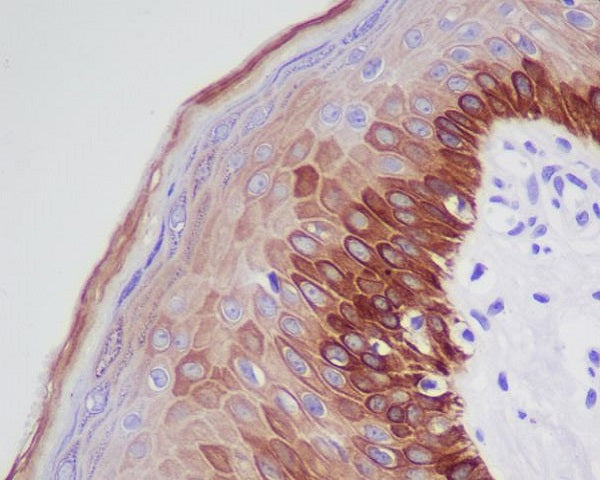 Anti-Cytokeratin 16 Rabbit Monoclonal Antibody