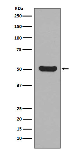 Anti-Cytokeratin 16 Rabbit Monoclonal Antibody