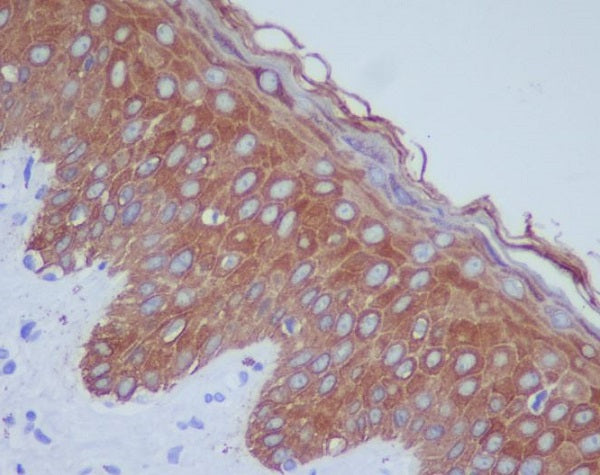Anti-Cytokeratin 14 Rabbit Monoclonal Antibody