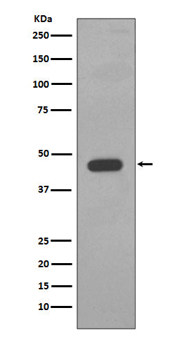 Anti-Cytokeratin 14 Rabbit Monoclonal Antibody