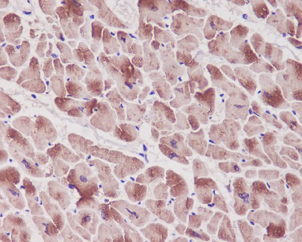 Anti-Cardiac Troponin I Rabbit Monoclonal Antibody
