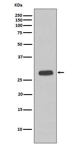 Anti-Cardiac Troponin I Rabbit Monoclonal Antibody