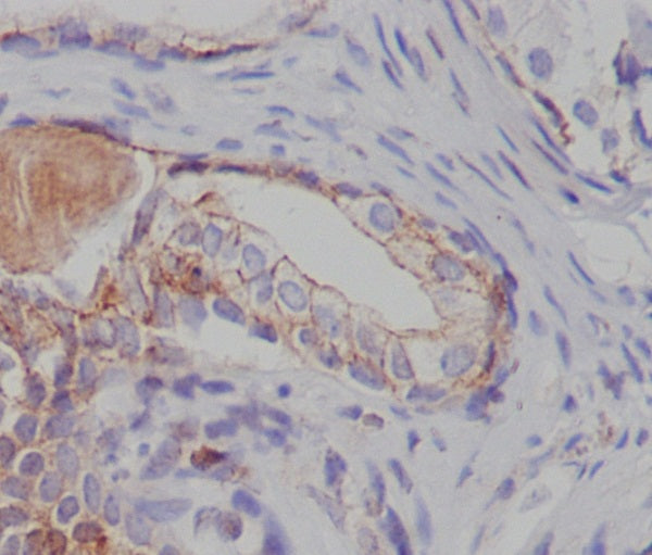 Anti-Tuberin Rabbit Monoclonal Antibody