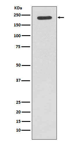 Anti-Tuberin Rabbit Monoclonal Antibody