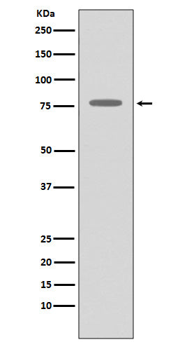 Anti-GRK2 Rabbit Monoclonal Antibody