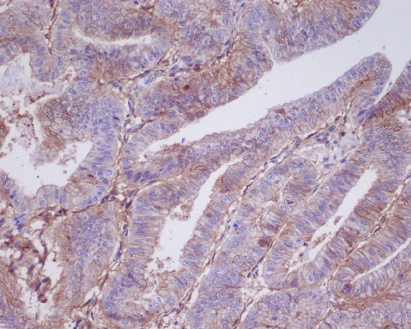 Anti-5T4 Rabbit Monoclonal Antibody