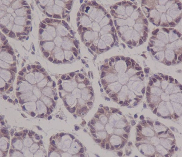 Anti-APC Rabbit Monoclonal Antibody