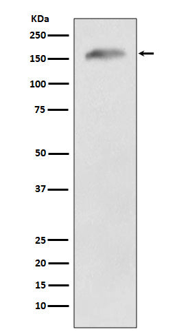 Anti-APC Rabbit Monoclonal Antibody