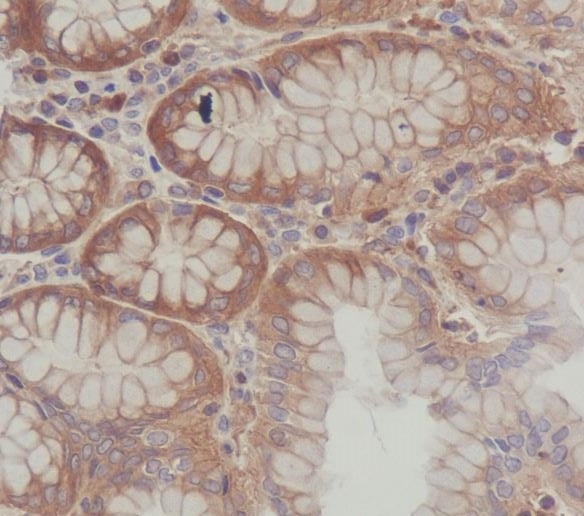 Anti-SCF Rabbit Monoclonal Antibody