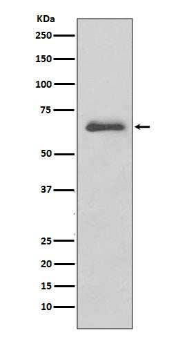 Anti-IRAKM Rabbit Monoclonal Antibody