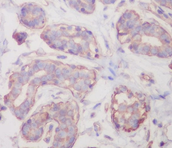 Anti-RALBP1 Rabbit Monoclonal Antibody