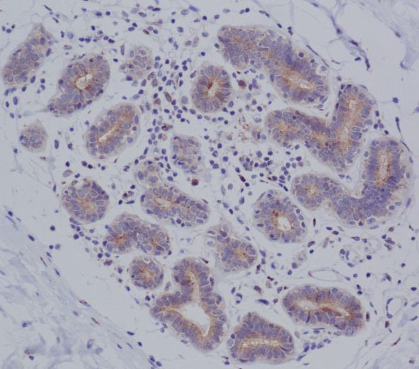 Anti-MyD88 Rabbit Monoclonal Antibody