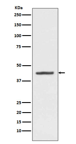 Anti-HMBS Rabbit Monoclonal Antibody