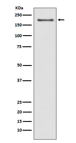 Anti-NSD3 Rabbit Monoclonal Antibody