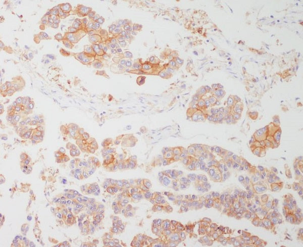 Anti-HLA DR Rabbit Monoclonal Antibody