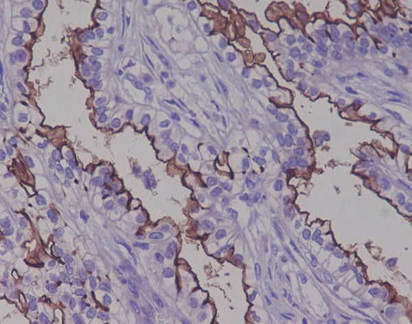 Anti-Mucin 1 Rabbit Monoclonal Antibody