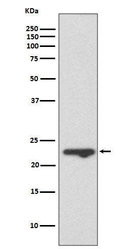 Anti-Mucin 1 Rabbit Monoclonal Antibody