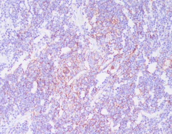 Anti-CD21 Rabbit Monoclonal Antibody