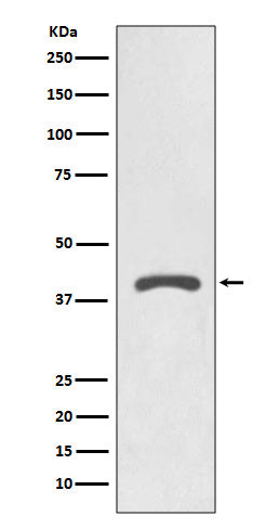 Anti-AGTR2 Rabbit Monoclonal Antibody