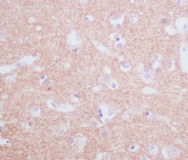 Anti-Tyrosine Hydroxylase Rabbit Monoclonal Antibody