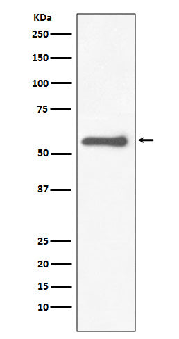 Anti-Tyrosine Hydroxylase Rabbit Monoclonal Antibody
