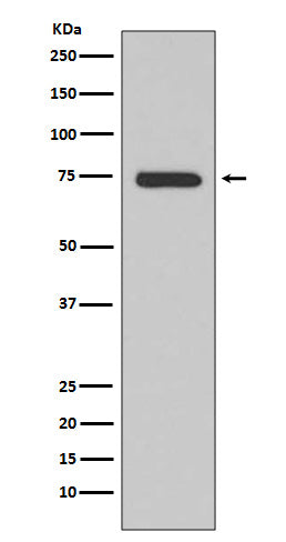 Anti-BTK Rabbit Monoclonal Antibody