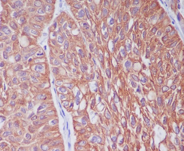 Anti-Cytokeratin 6A Rabbit Monoclonal Antibody