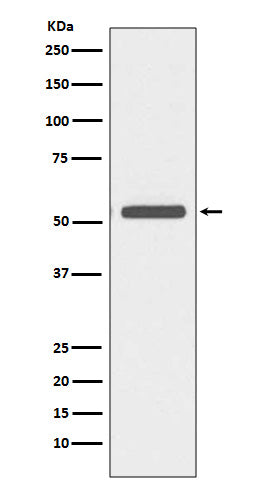 Anti-Cytokeratin 6A Rabbit Monoclonal Antibody