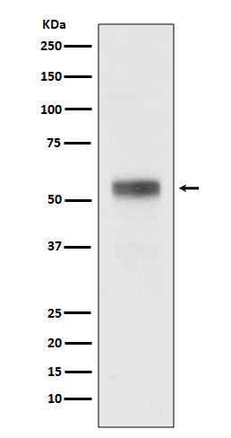 Anti-Retinoic Acid Receptor alpha Rabbit Monoclonal Antibody