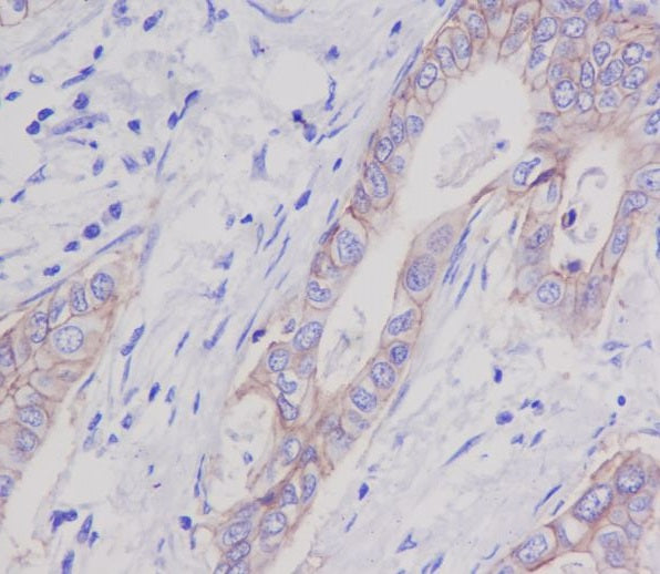 Anti-EpCAM Rabbit Monoclonal Antibody