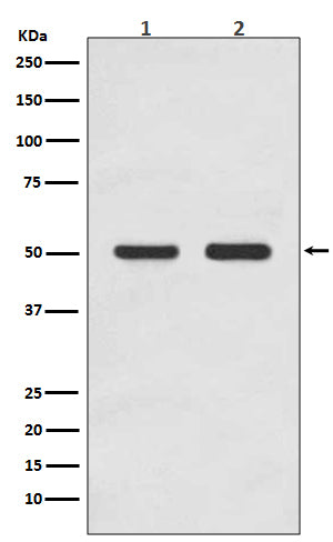 Anti-AP2M1 Rabbit Monoclonal Antibody