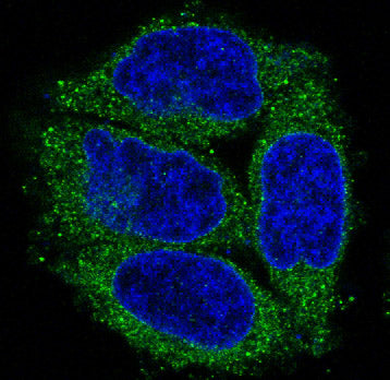 Anti-Cytokeratin 7 Rabbit Monoclonal Antibody