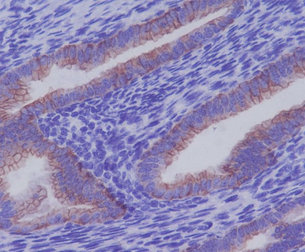 Anti-Cytokeratin 7 Rabbit Monoclonal Antibody