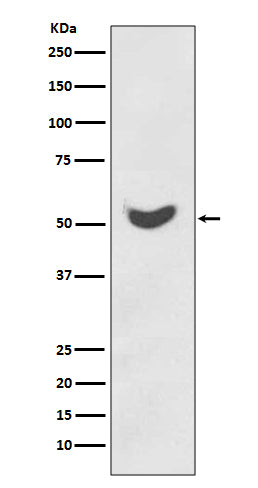 Anti-Cytokeratin 7 Rabbit Monoclonal Antibody