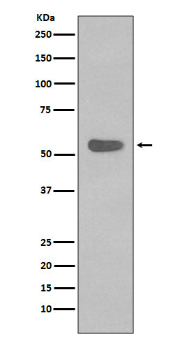 Anti-Cytokeratin 4 Rabbit Monoclonal Antibody