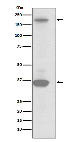 Anti-RON Rabbit Monoclonal Antibody