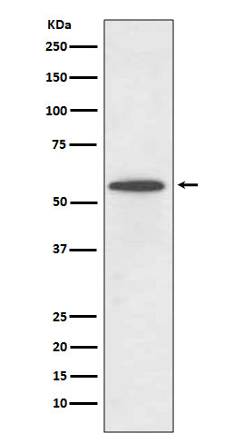 Anti-IRF5 Rabbit Monoclonal Antibody