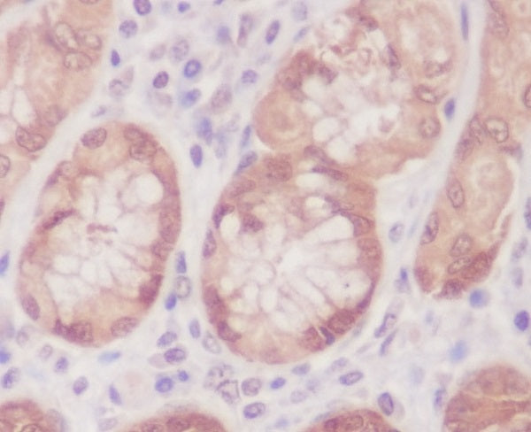 Anti-Caspase 6 Rabbit Monoclonal Antibody