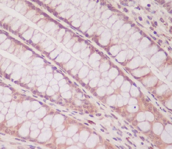 Anti-Smad1 Rabbit Monoclonal Antibody