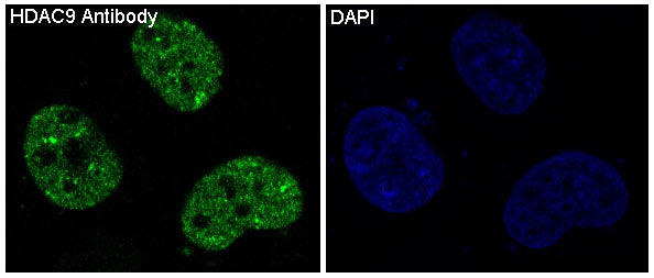Anti-HDAC9 Rabbit Monoclonal Antibody