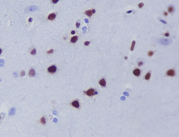 Anti-HDAC9 Rabbit Monoclonal Antibody