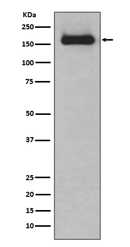 Anti-HDAC9 Rabbit Monoclonal Antibody