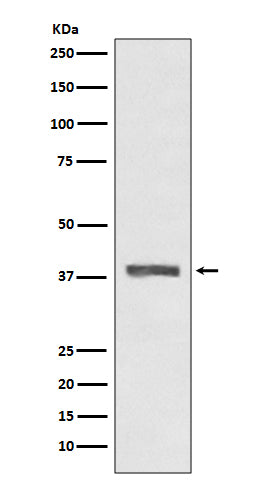 Anti-AMPK beta 1 Rabbit Monoclonal Antibody