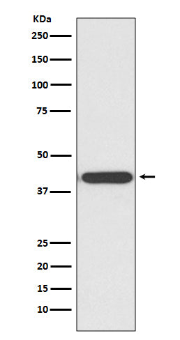 Anti-HDAC8 Rabbit Monoclonal Antibody