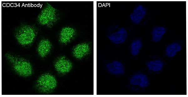 Anti-CDC34 Rabbit Monoclonal Antibody