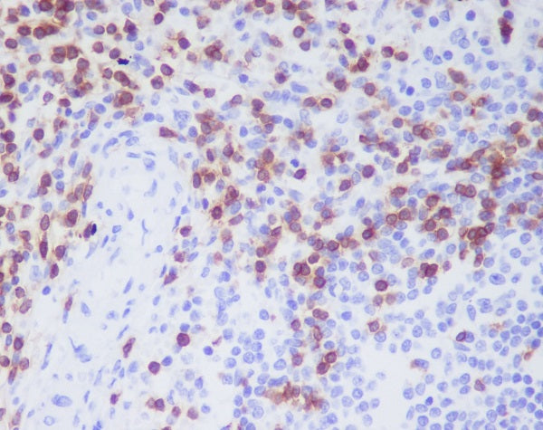 Anti-CD3D Rabbit Monoclonal Antibody