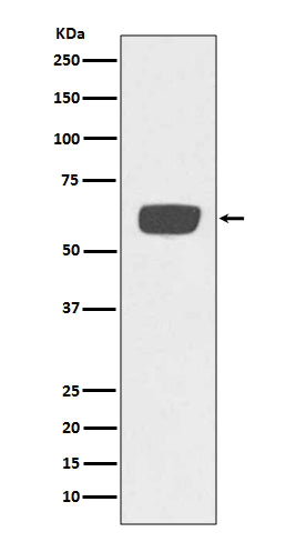 Anti-Tissue Type Plasminogen Activator Rabbit Monoclonal Antibody