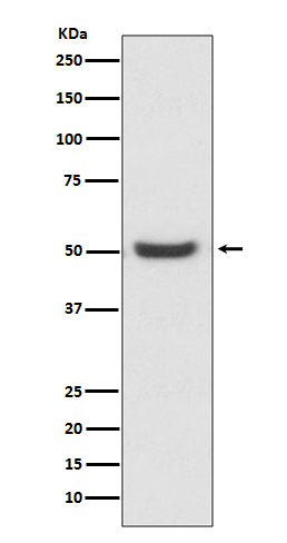 Anti-PDIA6 Rabbit Monoclonal Antibody